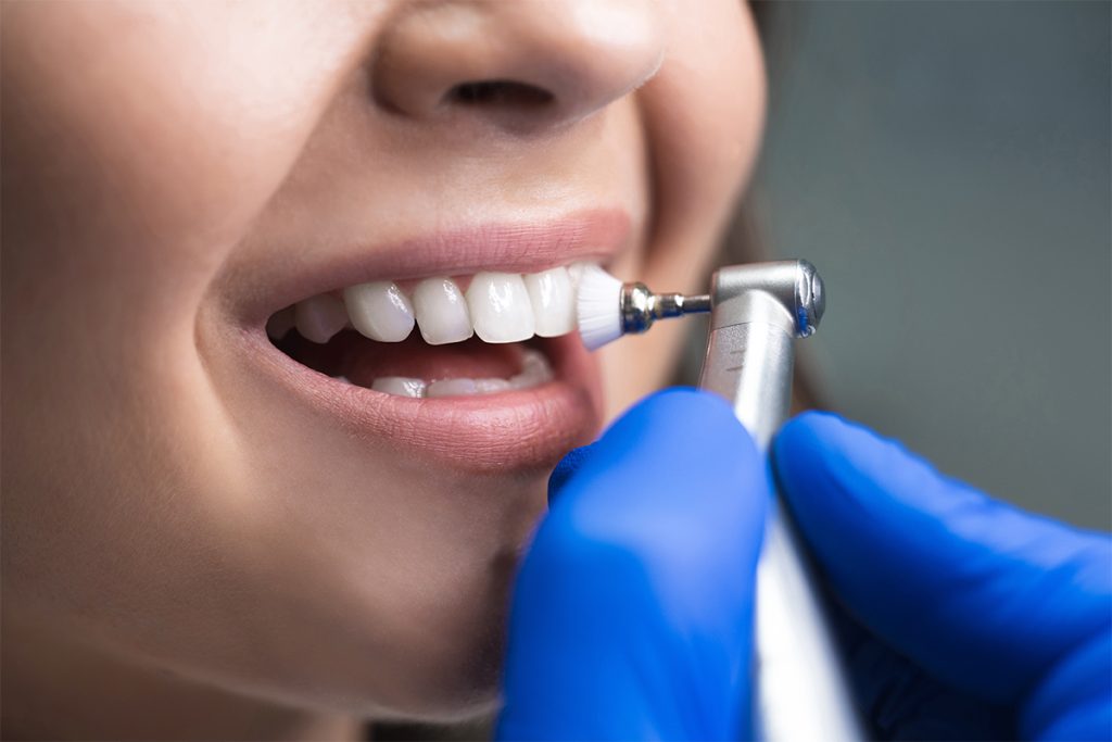 The Essential Role of Preventive Dental Care in Maintaining a Healthy Smile