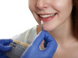 Cosmetic Dentistry