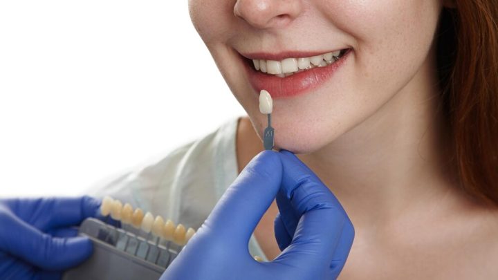 Cosmetic Dentistry